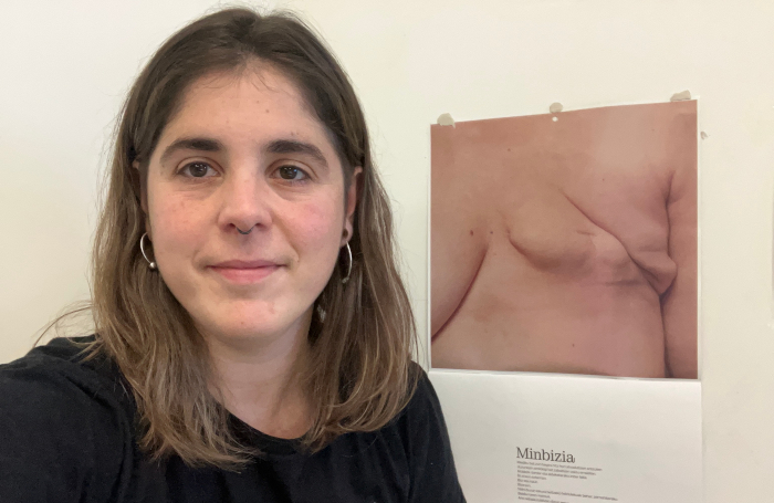 Gar Lozano Real: "Bularreko minbiziaren diagnostikoa jasotzen duten pertsona batzuen errealitatea gehiago ulertzeko beharra argi ikusi genuen"